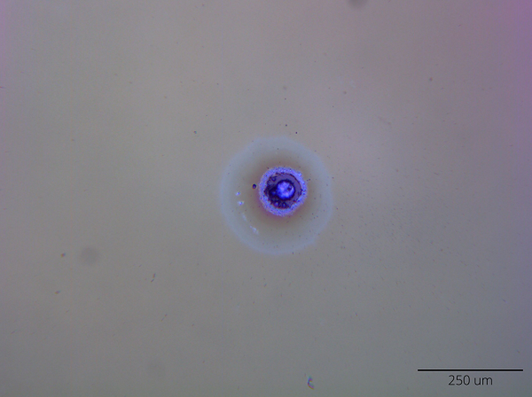 Figure 4: Image of laser induced damage captured using DIC microscopy