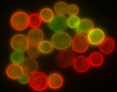 Figure 1: An image of protoplasts captured using confocal microscopy (left) that is more finely focused than an image of microspheres of a similar size captured using conventional epi-fluorescence microscopy.