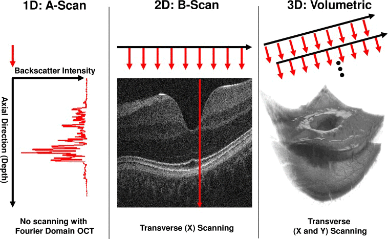 Figure 3: OCT image acquisition