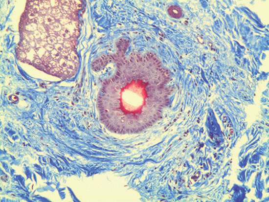 Trichrome Stain of Dermal Tissue Samples at 10X Magnification