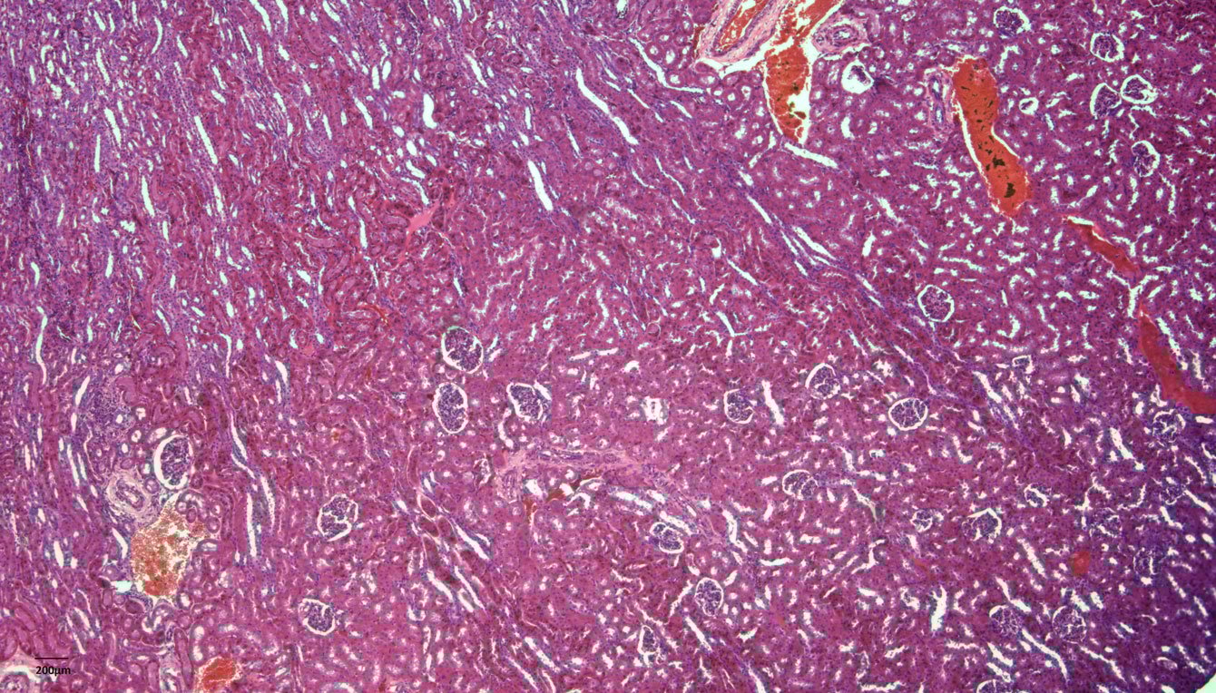 Kidney, Brightfield, 120i 5X Plan APO Infinity Corrected Objective