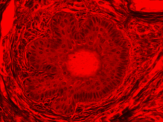 Brightfield Image of Dermal Tissue filtered with Red