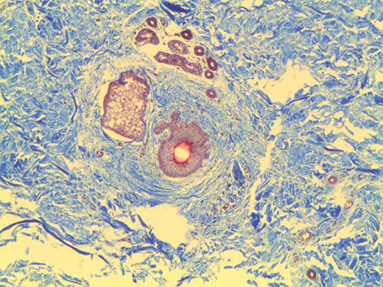 Trichrome Stain of Dermal Tissue Samples at 5X Magnification