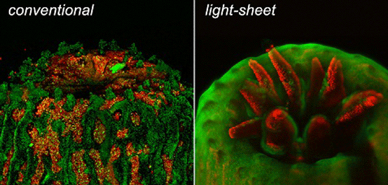 Light Sheet Microscopy