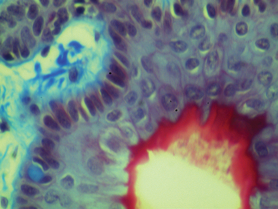 Trichrome Stain of Dermal Tissue Samples at 50X Magnification