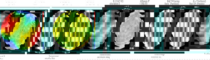 Surface Improvement